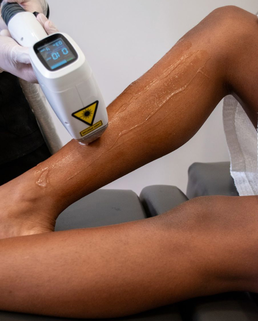 Laser hair removal device at ZClinic