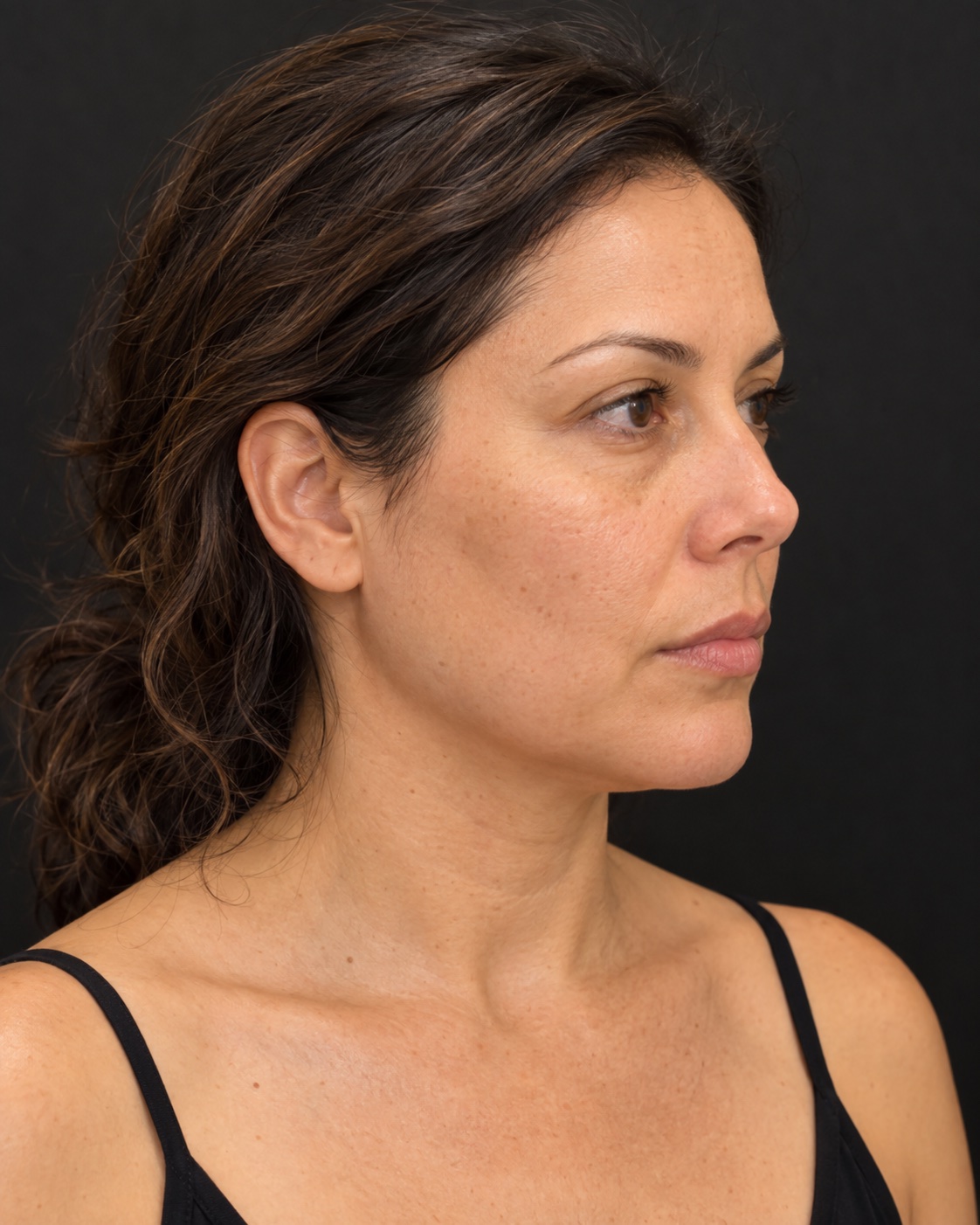 Client profile before treatment